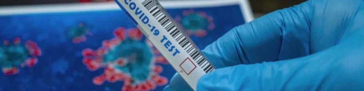 COVID-19: Cada boletim epidemiológico custa cerca de 400 euros
