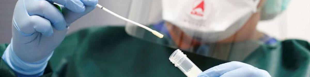 Onde fazer testes gratuitos à COVID-19? Tem direito a quatro/mês