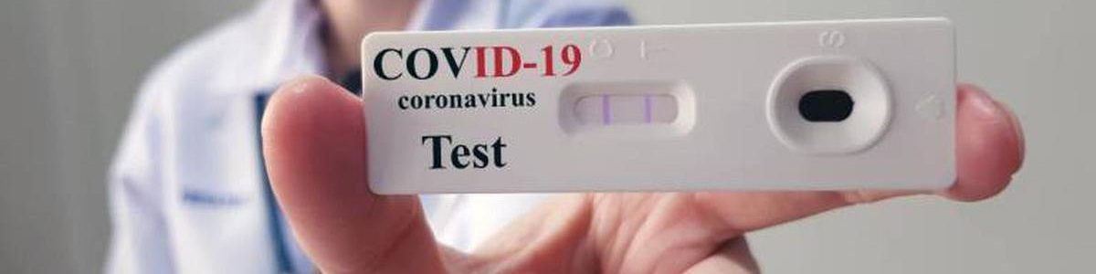 COVID-19: Farmácias com testes rápidos gratuitos, mas com receita