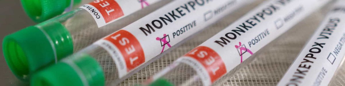 Monkeypox: Portugal é dos países com mais casos no mundo